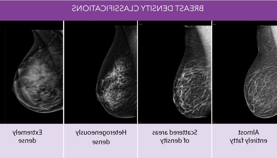 Breast Density Classifications: Almost entirely fatty, Scattered areas of density, Heterogeneously dense, Extremely dense
